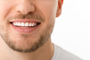 Man smiling with straight white teeth